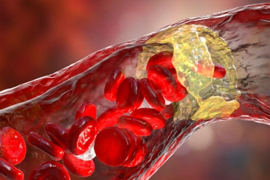 Cholesterol HDL - what is it?